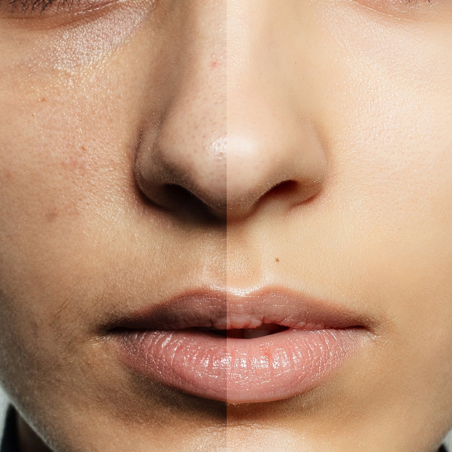 image comparison before